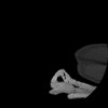 SPORK, NICO - 22.03.1976 - 02.08.2022 - CT obere Extremität - 17:51:17